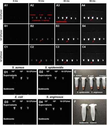 Real-Time In Vivo Detection and Monitoring of Bacterial Infection Based on NIR-II Imaging